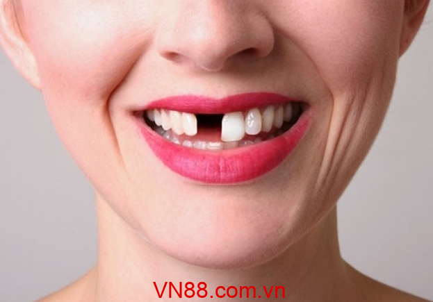 Mơ thấy rụng răng báo mộng điều gì